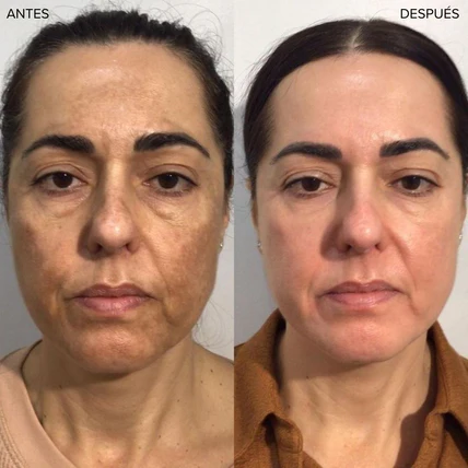 Base Adaptativa Biomimic 4 en 1