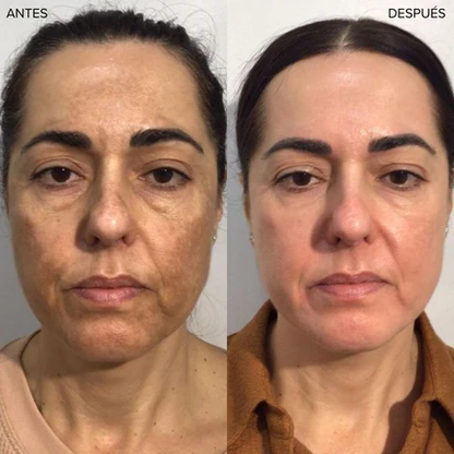 Base Adaptativa Biomimic 4 en 1